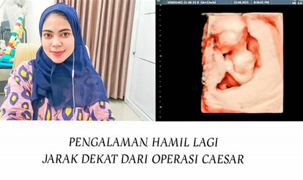 Temukan Manfaat Unik Hamil Jarak Dekat yang Menarik