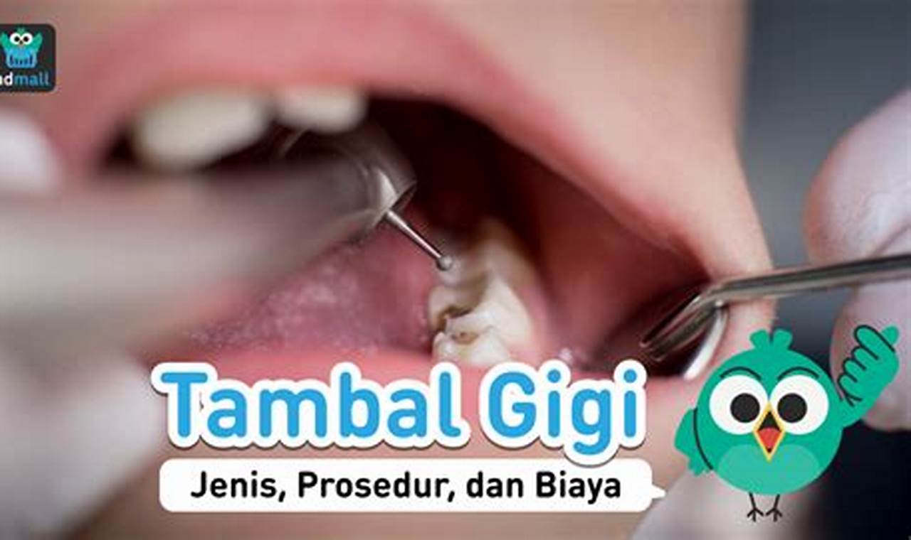 Ungkap 5 Manfaat Tambal Gigi yang Jarang Diketahui